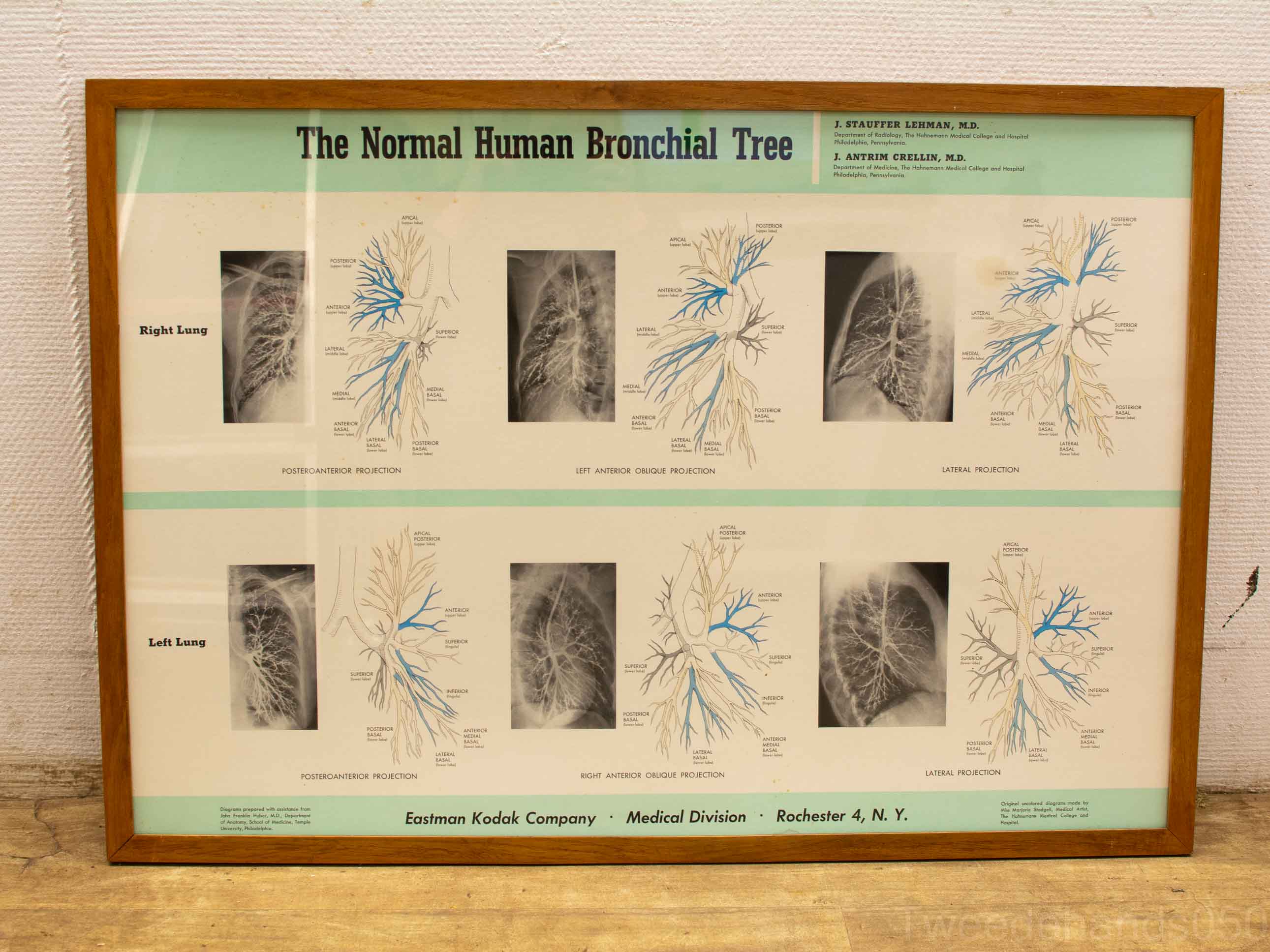 prent van the normal human bronchial tree 26867